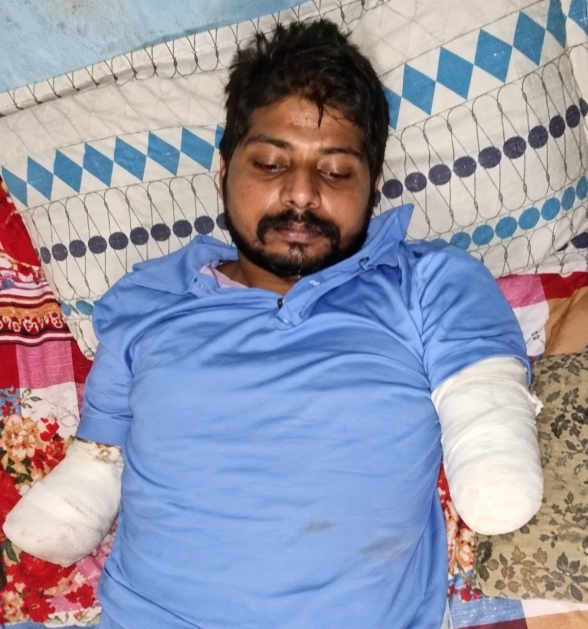 Sunil after his accident in 2022.